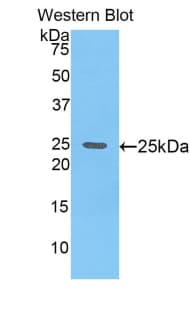 GPC4 / Glypican 4 Antibody (aa220-426)