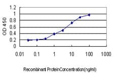 ALAS2 Antibody (clone 6C1)