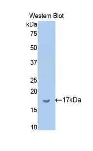 BCHE / Cholinesterase Antibody (aa29-150, Biotin)