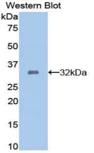 DKK1 Antibody (aa33-266)