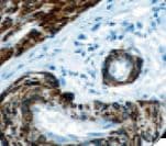 CALD1 / Caldesmon Antibody (Ready-to-Use)