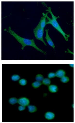 ALDOC / Aldolase C Antibody (clone AT2E11)