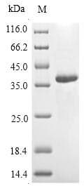 Vespula vulgaris PSPLA1 / Phospholipase A1 Protein (Recombinant 6His-Myc, C-terminus)