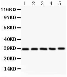 SRSF1 / SF2 Antibody (aa6-33)