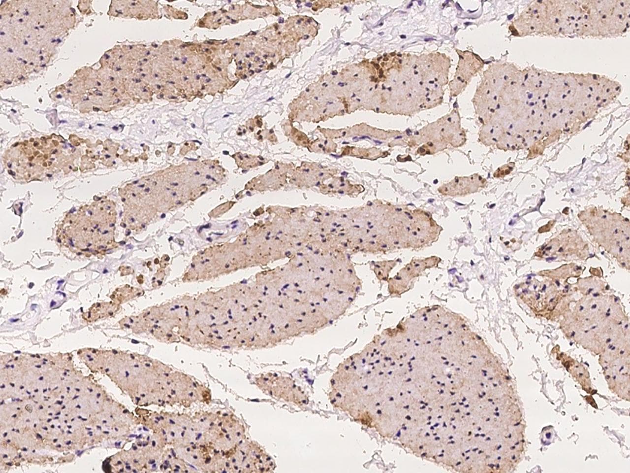 ZFP36L2 Antibody