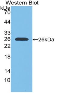 IGF1R / IGF1 Receptor Antibody (aa763-955)