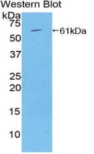 THBS4 / Thrombospondin 4 Antibody (aa708-963, HRP)