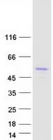 Human ARA55 / HIC-5 Protein (Recombinant Myc-DDK (Flag))