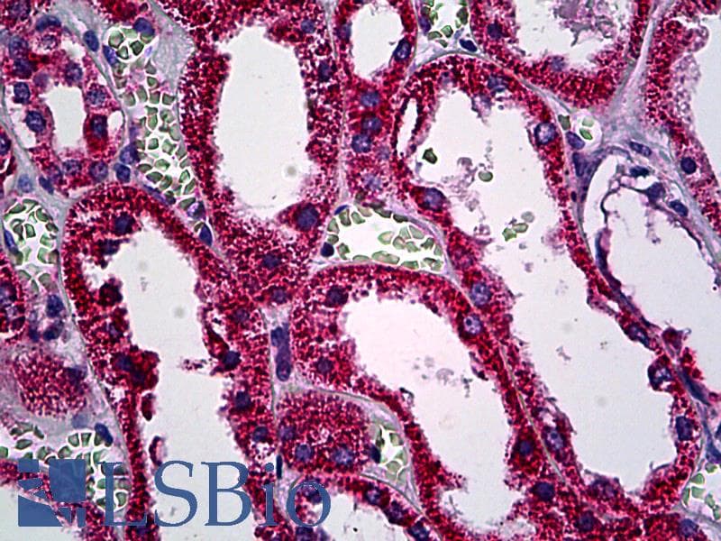 IHC-plus™ Polyclonal Rabbit anti-Human Pan Ras Antibody (aa1-50, IHC, WB)