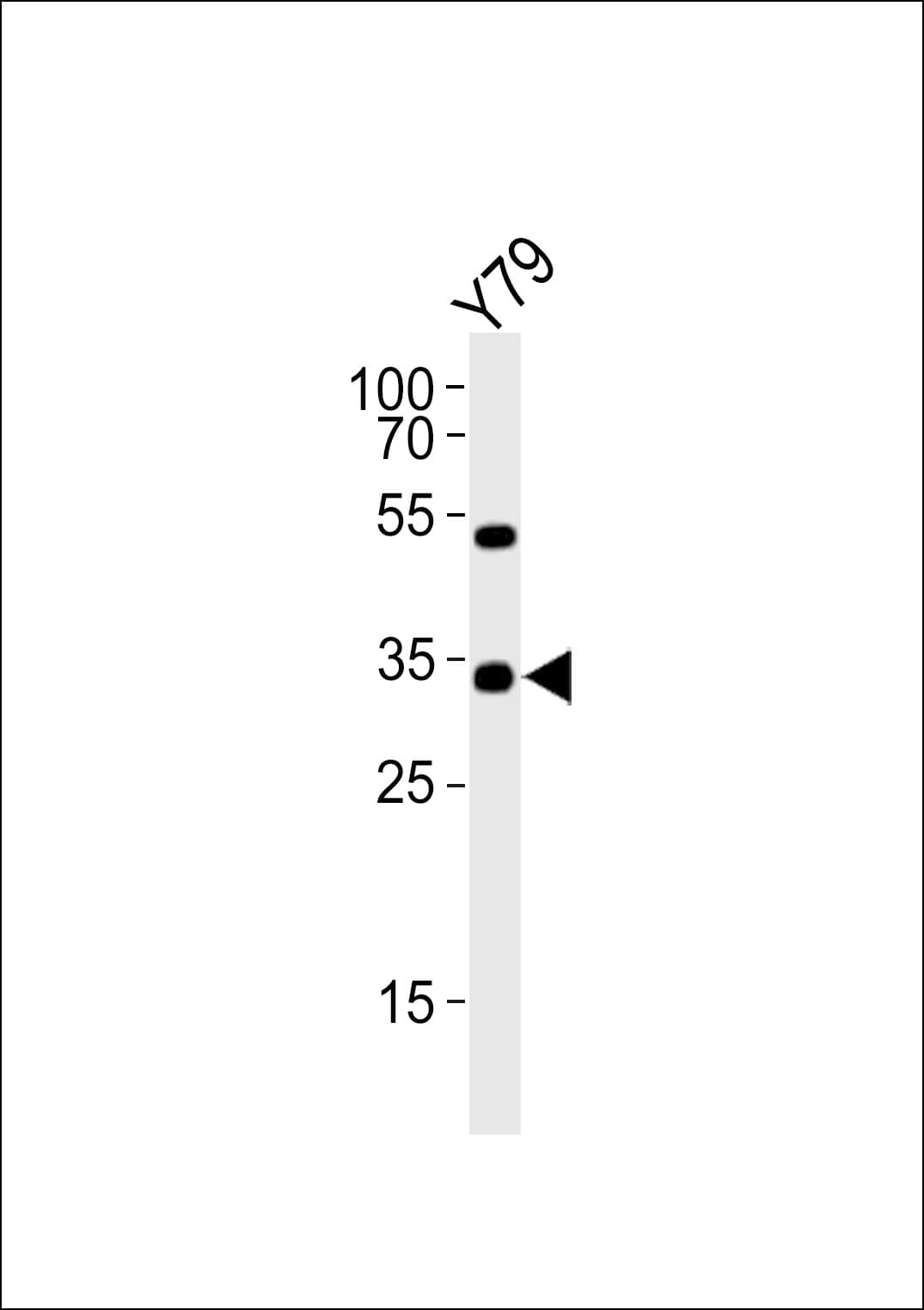 OTX2 Antibody (aa102-135)