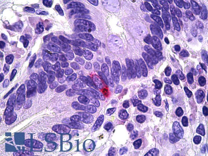 IHC-plus™ Polyclonal Goat anti-Human PPY / Pancreatic Polypeptide Antibody (aa61-73, IHC)