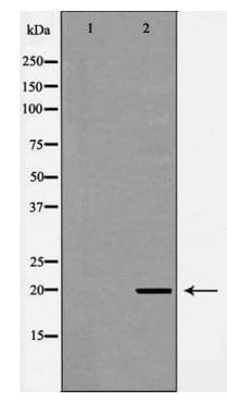 TWIST1 / TWIST Antibody