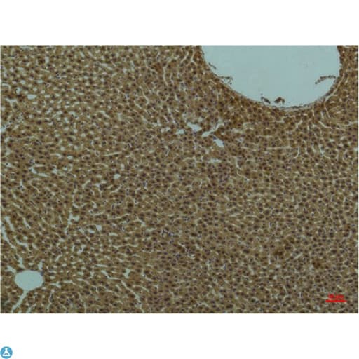 PIK3R1 / p85 Alpha Antibody