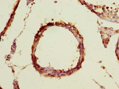 TBC1D19 Antibody