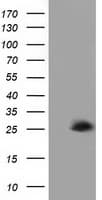 AK3 / Adenylate Kinase 3 Antibody (clone OTI4C4)