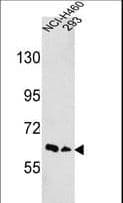 IHC-plus™ EPHA3 / EPH Receptor A3 Antibody (aa115-144)