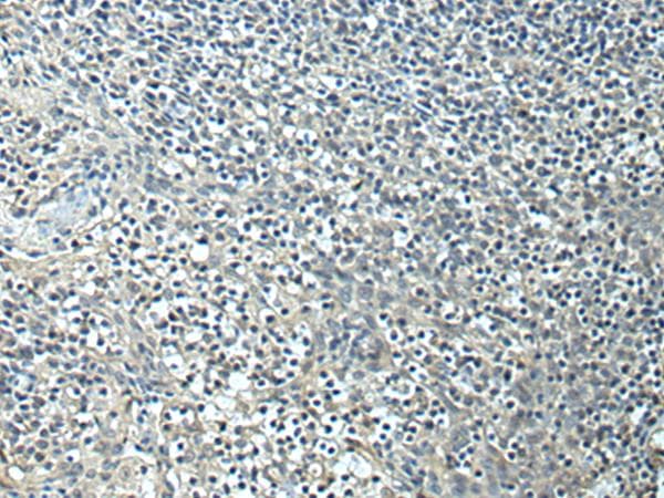 Polyclonal Rabbit anti-Human SLC35F6 Antibody (IHC)