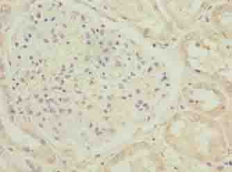 Polyclonal Rabbit anti-Human C17orf47 Antibody (IHC)