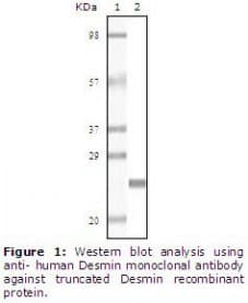DES / Desmin Antibody (clone 10H7D2)
