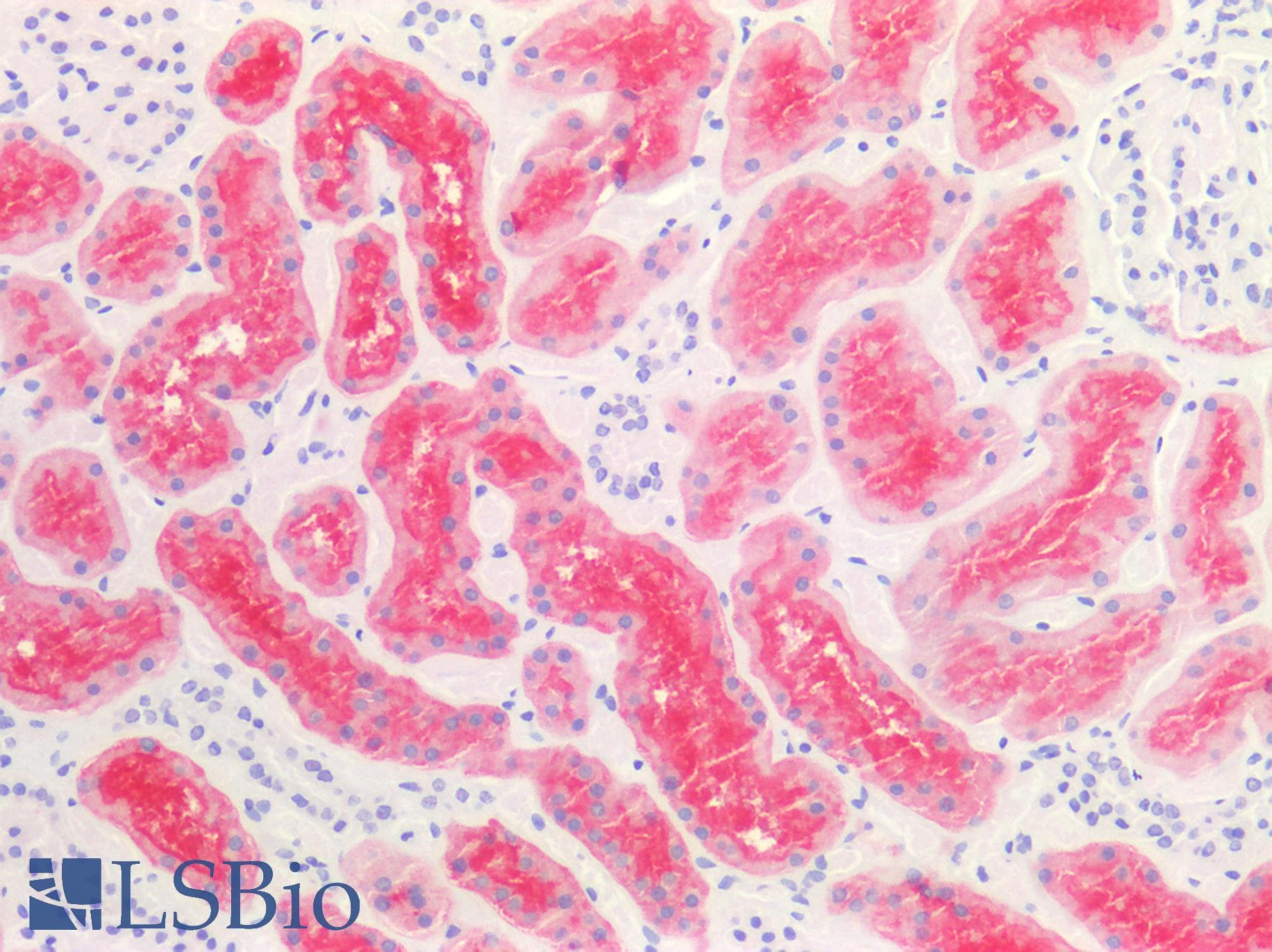 Monoclonal Mouse anti-Human ACE2 / ACE-2 Antibody (clone AC18F, IHC, WB)