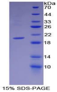 Mouse GDF10 / BMP3B Protein (Recombinant His, N-Terminal)