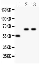 CYP2E1 Antibody (aa1-310)
