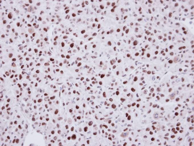 Polyclonal Rabbit anti-Human LDB1 / CLIM2 Antibody (aa86-411, IHC, WB)