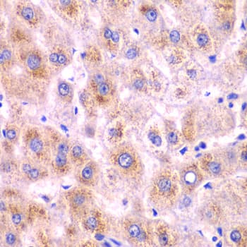 Polyclonal Rabbit anti-Human DDX1 Antibody (IHC, IF, WB)