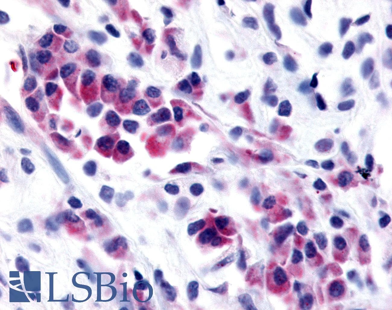 PathPlus™ Polyclonal Rabbit anti-Human NEK9 Antibody (Kinase Domain, IHC)