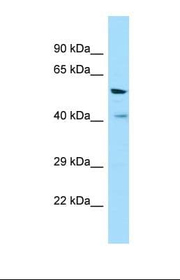 Polyclonal Rabbit anti-Human V1RL1 / VN1R1 Antibody (aa253-302, WB)
