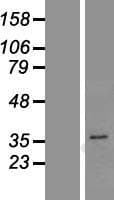 PGAP3 / PERLD1 Protein (Over-Expression Lysate Myc-DDK (Flag))