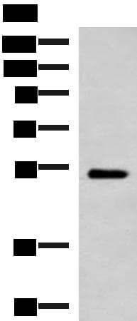 Polyclonal Rabbit anti-Human FUCA2 Antibody (IHC, WB)