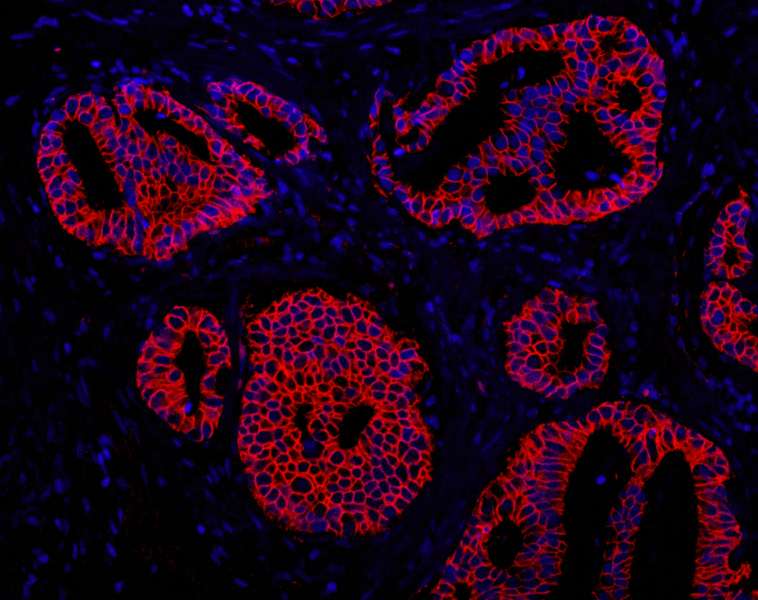 Polyclonal Rabbit anti-Human ABCB9 Antibody (aa475-525, IHC, IF)