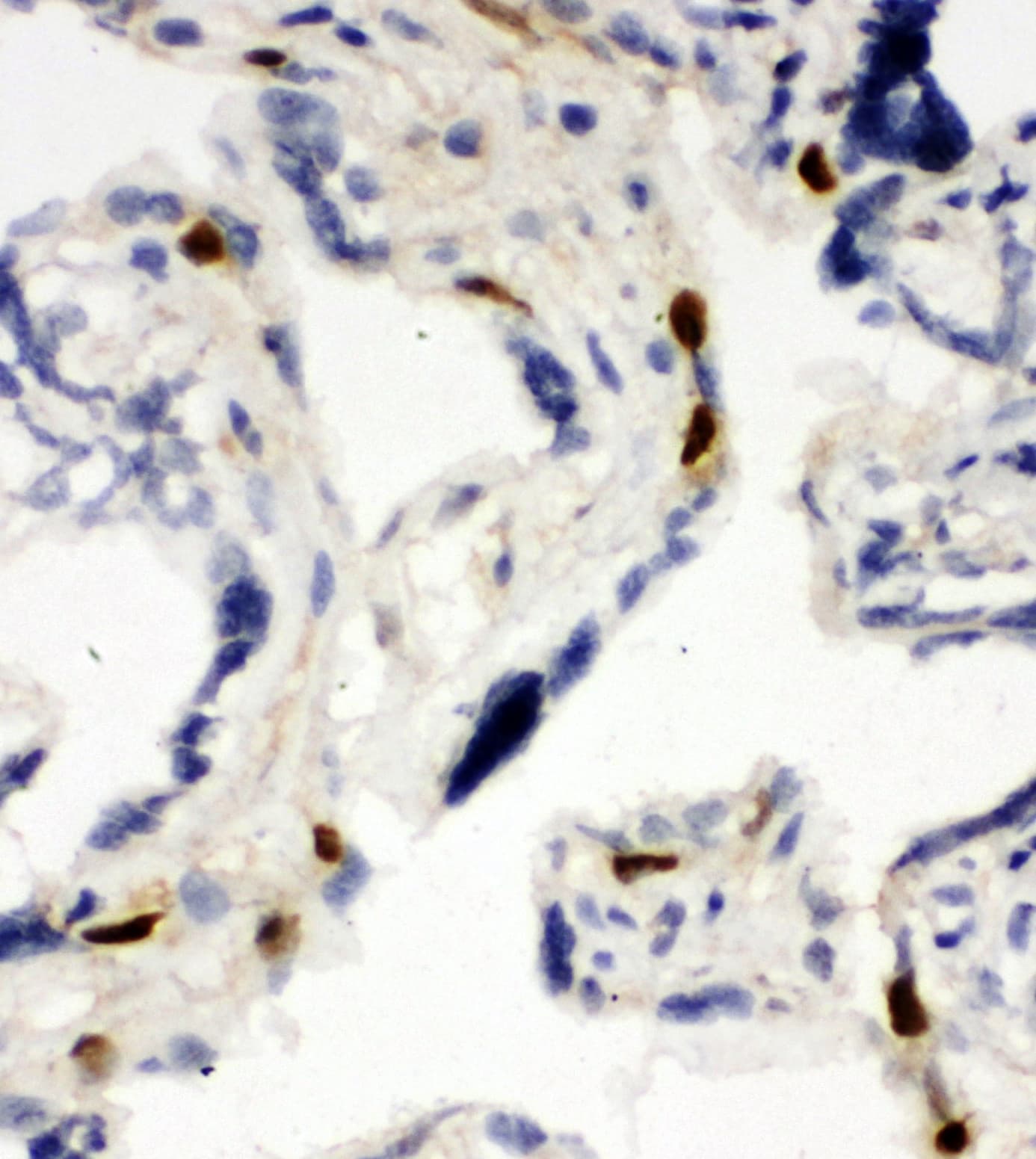 Polyclonal Rabbit anti-Human MCM6 Antibody (aa589-605, IHC, WB)