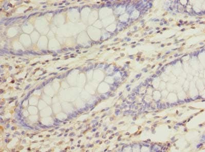 Polyclonal Rabbit anti-Human RUSC1 Antibody (IHC)