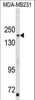 TBC1D4 / AS160 Antibody (aa172-201)