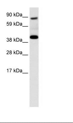 Polyclonal Rabbit anti-Human SERPINF1 / PEDF Antibody (N-Terminus, IHC, WB)