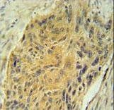 Polyclonal Rabbit anti-Human AVP / ADH / Vasopressin Antibody (aa102-129, IHC, IF, WB)