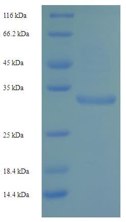 Human KLRC2 / NKG2C / CD159c Protein (Recombinant His-SUMO)