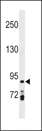 PRICKLE1 Antibody (aa678-704)