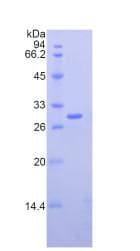 Mouse NCL / Nucleolin Protein (Recombinant His)
