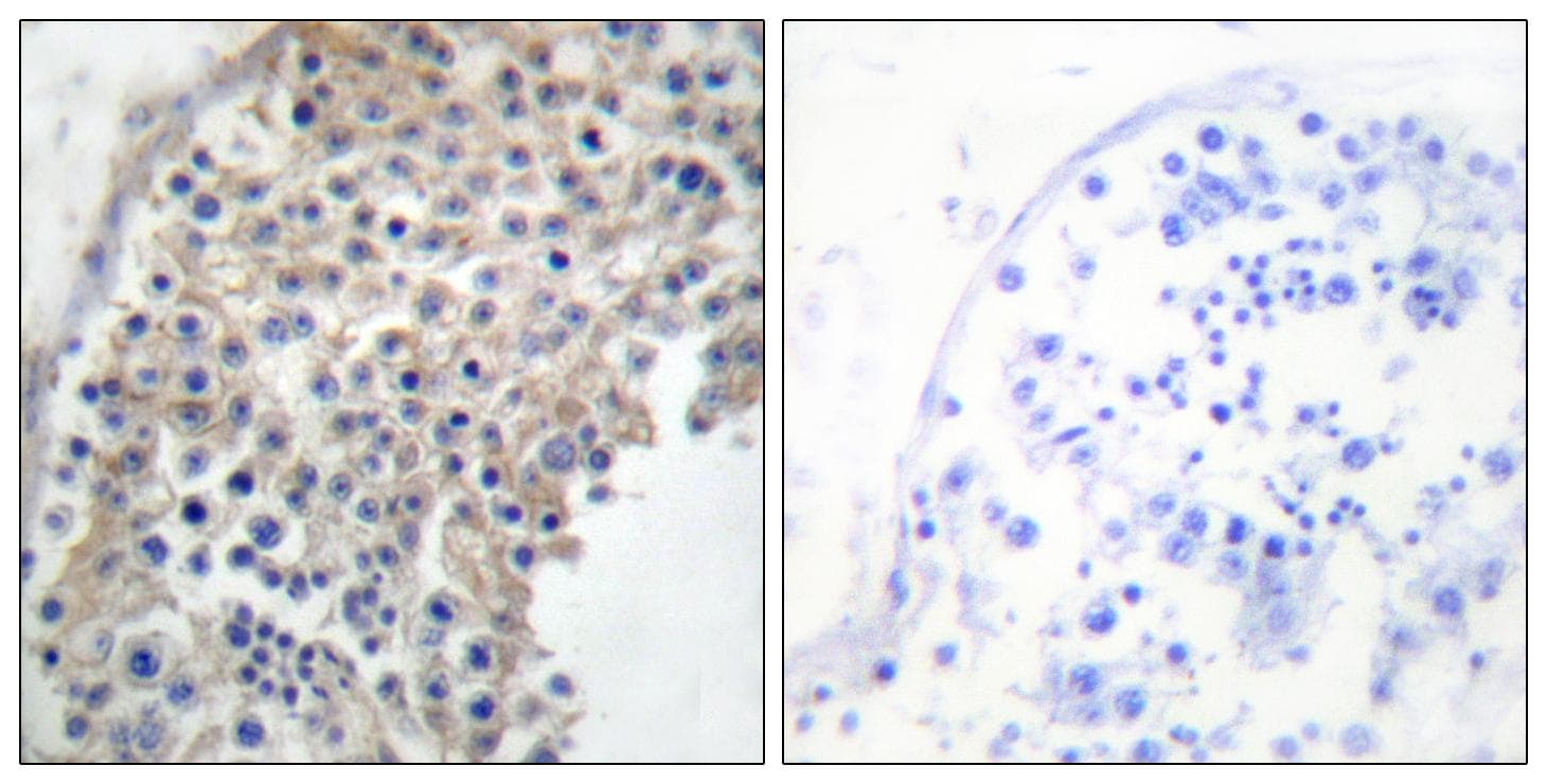 Polyclonal Rabbit anti-Human ADRA2A Antibody (IHC, IF, WB)