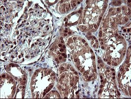 Placental Lactogen Antibody (clone OTI2G4)
