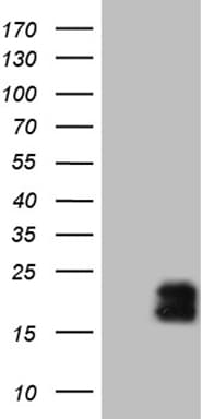 Monoclonal Mouse anti-Human GLOD2 / MCEE Antibody (clone OTI3B11, IHC, WB)