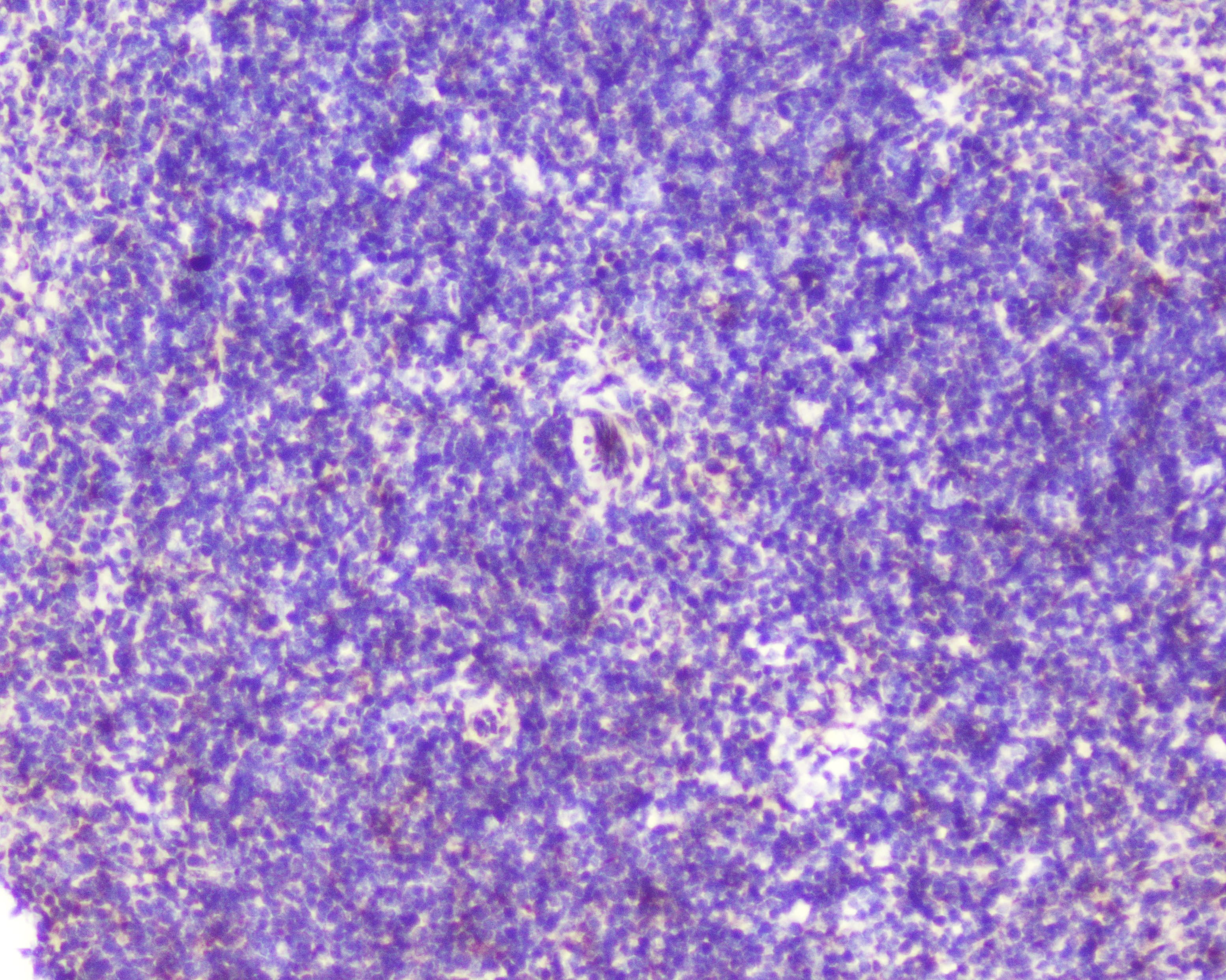Polyclonal Rabbit anti-Human GOLGA2 / GM130 Antibody (IHC, WB)