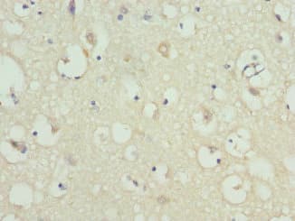 Polyclonal Rabbit anti-Human KCNIP2 / KCHIP2 Antibody (IHC)