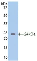 GAD65 Antibody (aa188-374)