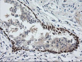CATIP / C2orf62 Antibody (clone OTI2E6, Carrier-free)