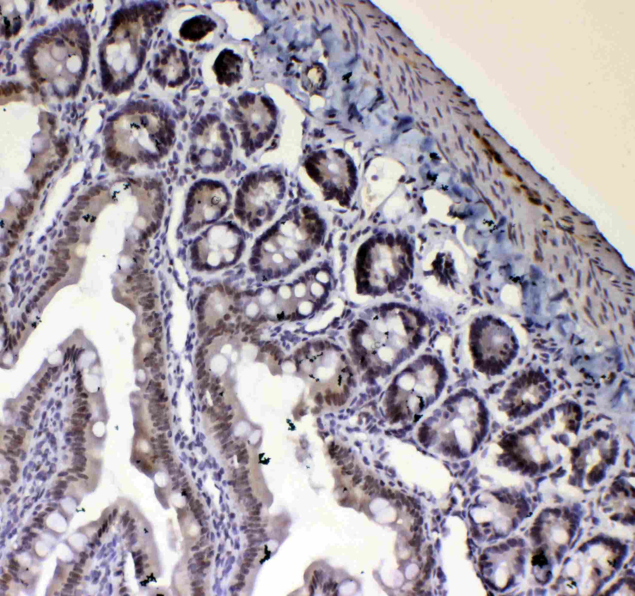 BLIMP1 / PRDM1 Antibody