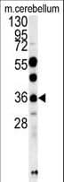 OTUD6B Antibody (aa234-262)